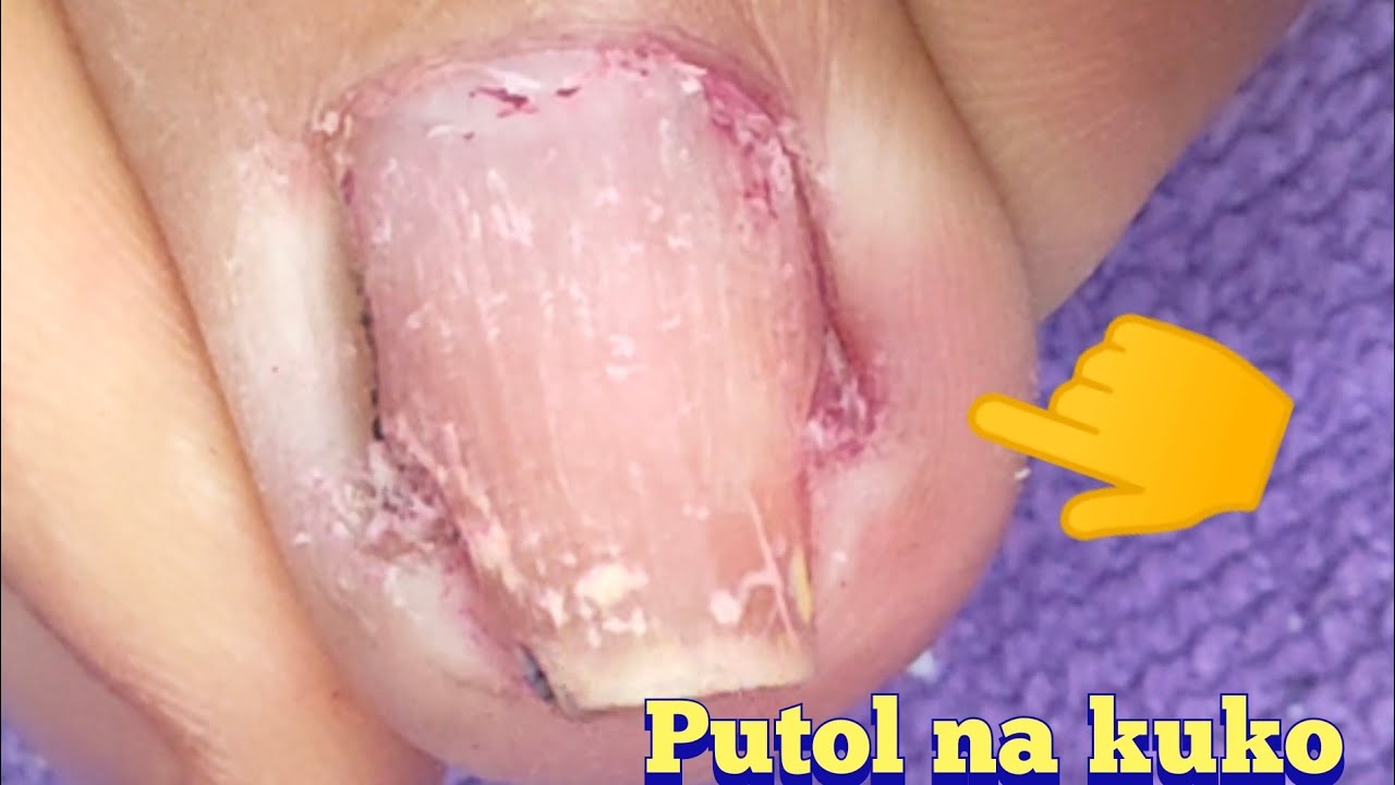 PUTOL NA KUKO SA GILID. - YouTube