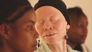 Tanzania Albinism Collective Mini-Documentary