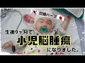 生後9か月で脳腫瘍になりました。생후9개월, 뇌종양에 걸렸습니다.