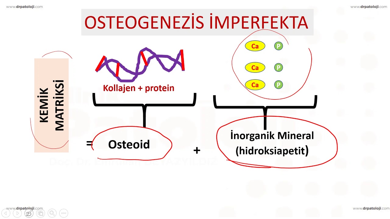 Nonneoplastik Kemik Hastalıkları
