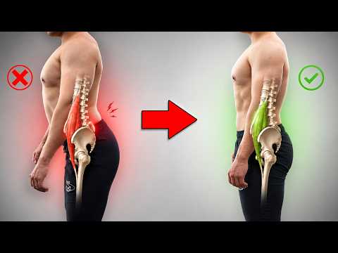 Iliopsoas cut