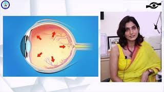 Diagnosis and treatment of Glaucoma | Dr. Sahebaan Sethi | Catarct & Glaucoma Consultant | ADEH