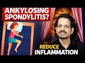 Ankylosing Spondylitis | What Actually Works (And What Doesn't)