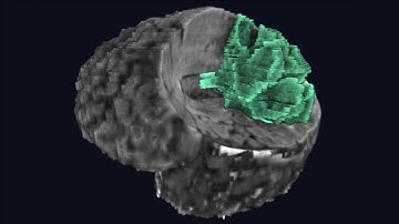 Interactive Volumetric Region Growing for Brain Tumor Segmentation on MRI using WebGL :: Web3D 2021