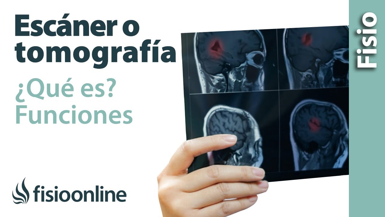 como se realiza una tomografia de craneo