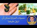 الدكتور محمد فائد || حصوات المرارة يمكن أن تزول طبيعيا