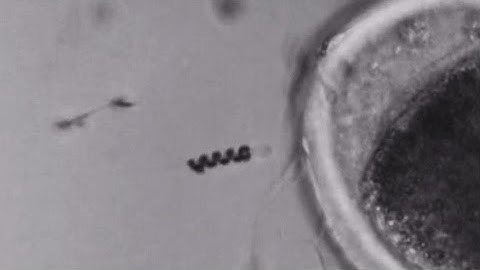 Spermbots deliver sperm to egg