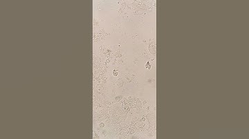 Trichomonas vaginalis in the urine #laboratory #mls #medtechstudent #microscope #microbiology #cls