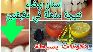 تبييض الأسنان في دقيقتين نتيجة مذهلة بمكونات بسيطة blanchiment les dents en 2 minutes