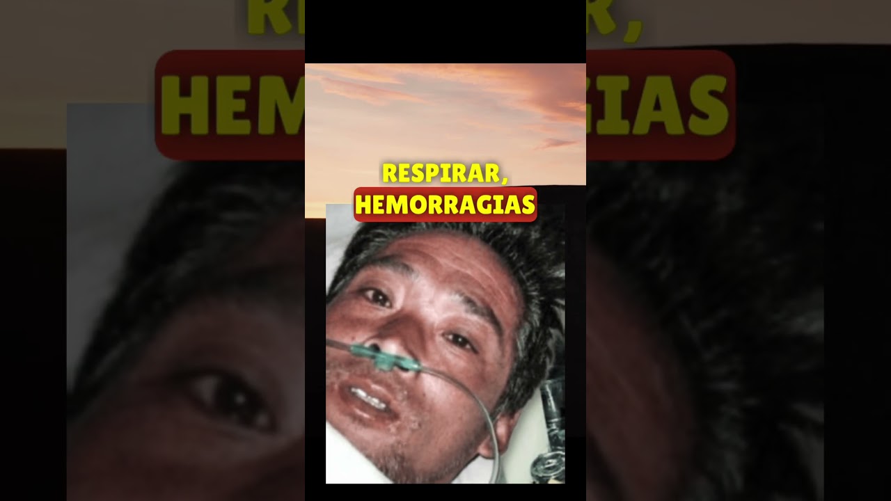 El hombre que sufrió la MAYOR carga RADIOACTIVA de la historia.