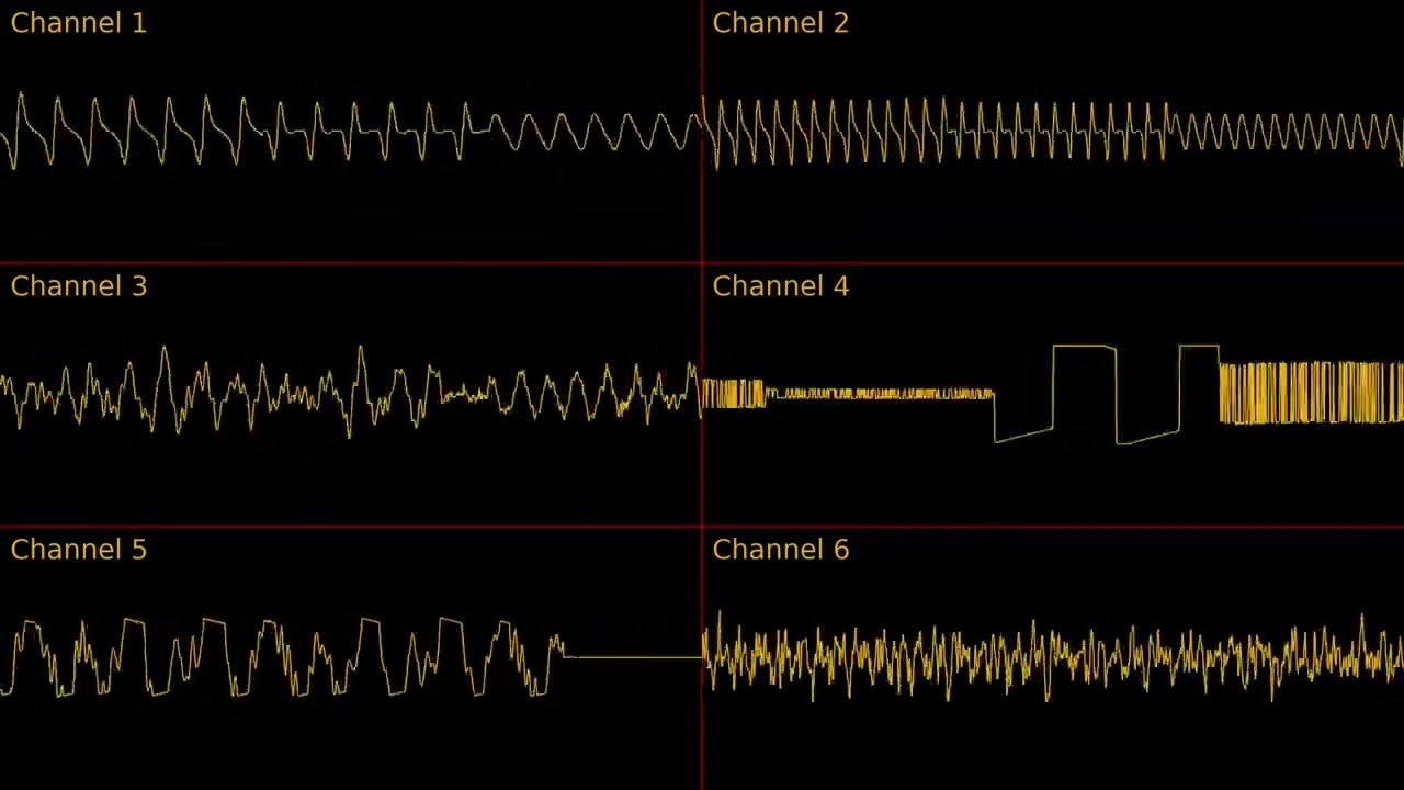 Plok - Cotton Island (SNES) [BoSU Cover]