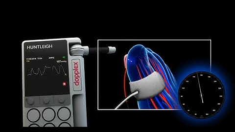Toe Pressure Index with Dopplex DMX