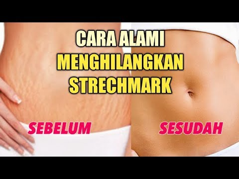 Video: Cara Mudah Mencerahkan Kulit Selepas Kehamilan: 7 Langkah