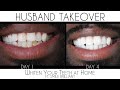 How to Whiten Your Teeth At Home | Smile Brilliant