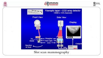 Mammography