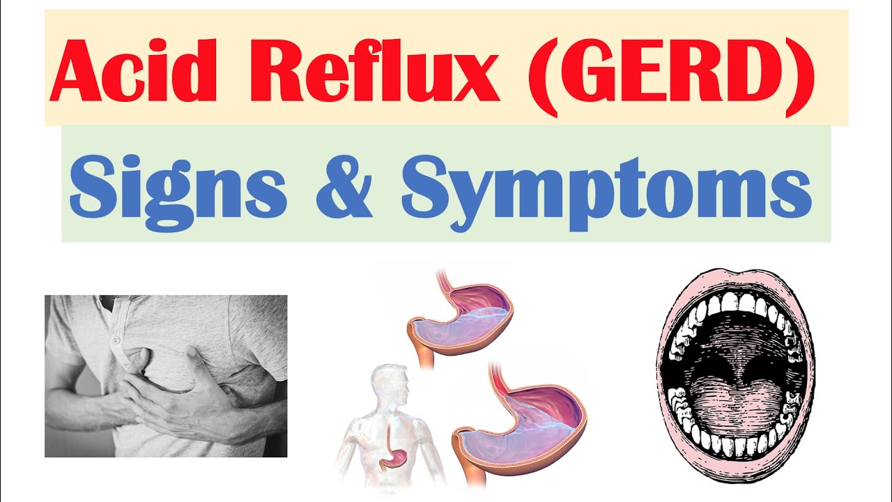 Gastroesophageal Reflux Disease (GERD)