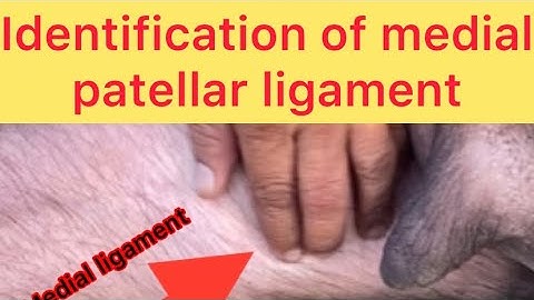 Demonstration of MPD l Identification of medial patellar ligament l Dr umar khan