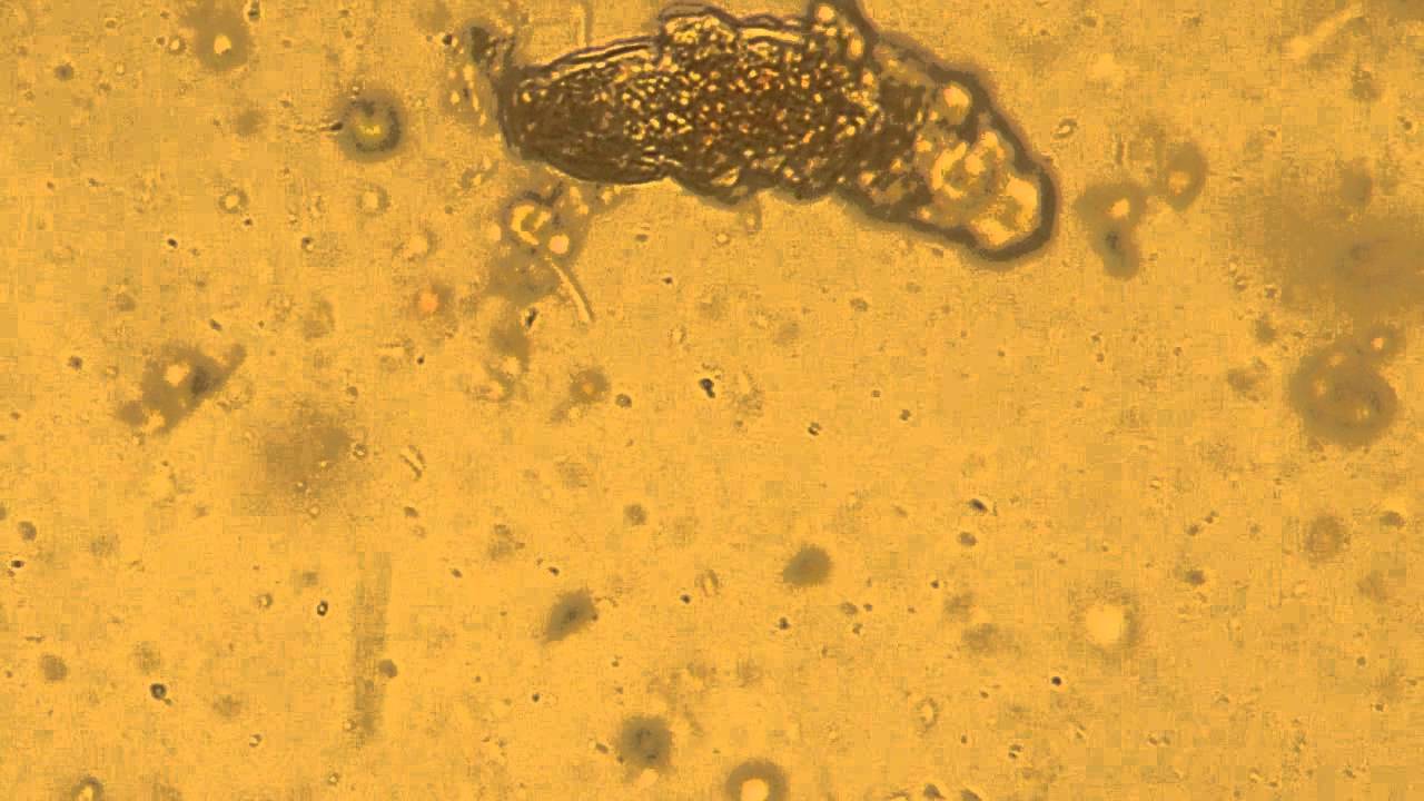 Tardigrade viewed through a Carl Zeiss Binocular Microscope, image capture, Nikon
