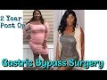 2 YEARS POST OP GASTRIC BYPASS! REGAIN,SEX LIFE, SOCIAL STATUS AND MORE!