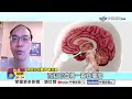 聯電宣明智"腦硬膜外出血"急手術 "頭痛臉歪"曝警訊!│中視新聞 20260719