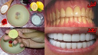 وصفة سهلة لتنظيف الأسنان الصفراء القذرة في المنزل | الحصول على تبييض الأسنان على الفور