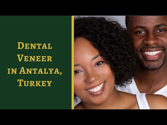 Effective Package For Dental Veneer In Antalya Turkey