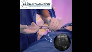 Carlos Enrique Villegas Nuñez-33