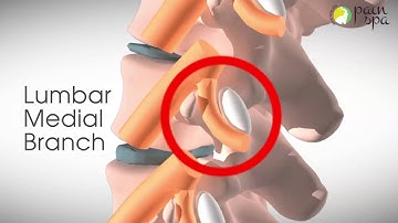 Diagnostic Lumbar Medial Branch Blocks