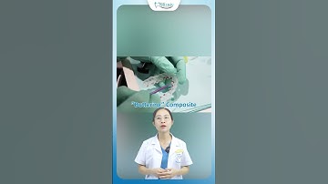 Công Nghệ Niềng Răng Mặt Lưỡi Cho Răng Khấp Khểnh | Nha Khoa Minh Châu