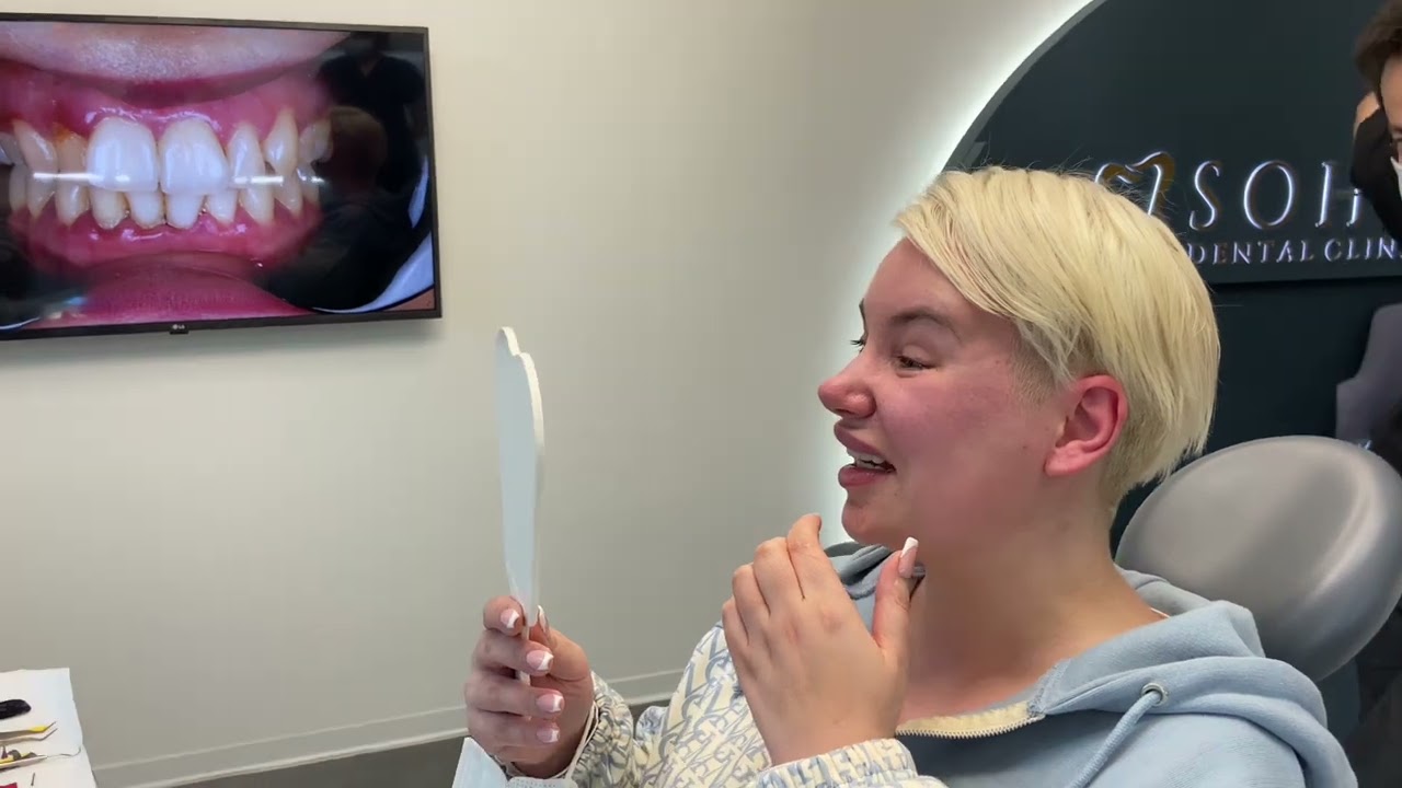 Smile Makeover: Laminate Veneer Treatment Process