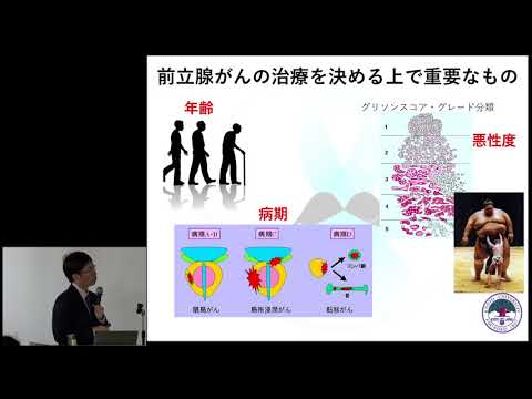 今日からわかる！前立腺がんの診断から治療前まで　井上 貴博