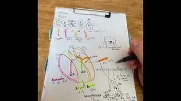PCCN Review - ECG/EKG leads "LISAL"