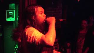 Cartilage - Half the Man I Used to Be