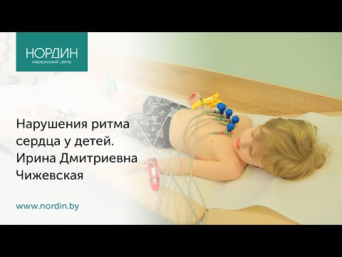 Нарушения ритма сердца у детей, врач Ирина Чижевская