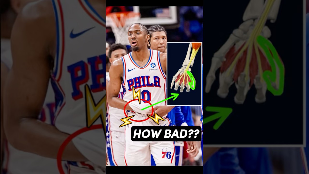 #TyreseMaxey exits with a painful shooting hand injury | Doctor explains! #76ers #philadelphia76ers