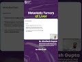 Metastatic Tumors of Liver | Dr. Shailesh Gupta | Surgery Residency
