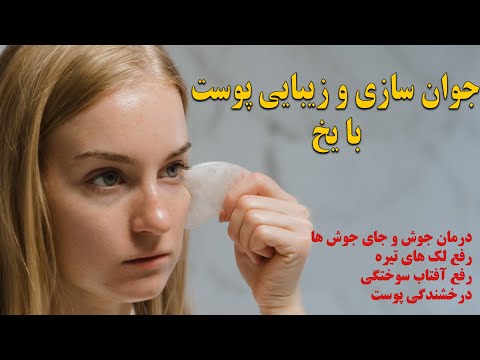 تصویری: 3 روش برای یخ زدن پوست