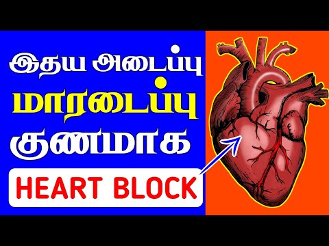 இதய அடைப்பு | How to Cure Heart Blockage NATURALLY in Tamil | Thanithuvamm