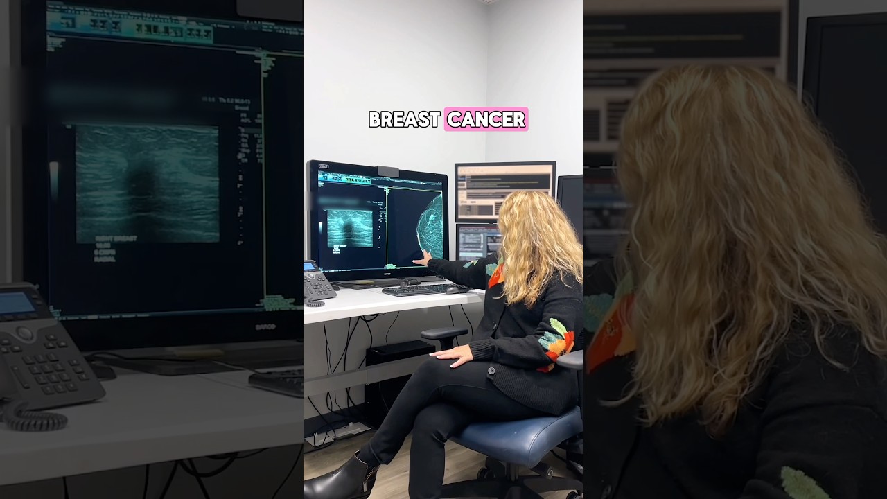 Here’s what a Radiologist looks for on daily basis on mammograms & breast ultrasounds👆 #mammogram
