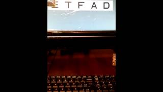 Foresight oculi up and down not working