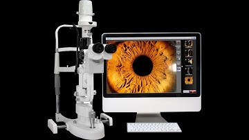 [Phoenix-1]How to install Phoenix digital imaging  module onto slit lamp?