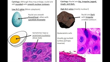 Squamous Mucosa of the Upper Aerodigestive Tract: Kurt