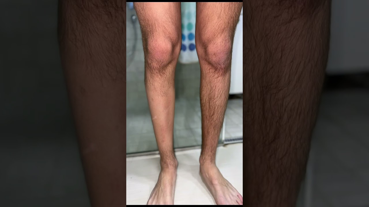 Dlačice su moja prošlost❌ Floerty Nano Crystal Epilator