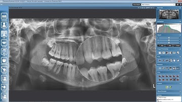 Processing 2D images in Planmeca Romexis©