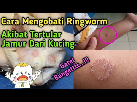 Cara Mengobati Ringworm Akibat Tertular Jamur Dari Kucing