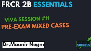 VIVA session #11 MIXED cases,How to tackle FRCR 2B VIVA cases ? Do not miss this interactive session