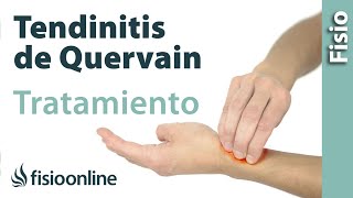 Tendinitis de De Quervain  Tratamiento con ejercicios, automasajes y estiramientos