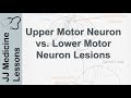 Upper and lower motor neuron lesions  umn vs lmn differences and mnemonic