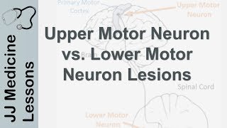 Upper and Lower Motor Neuron Lesions | UMN vs LMN, Differences and Mnemonic