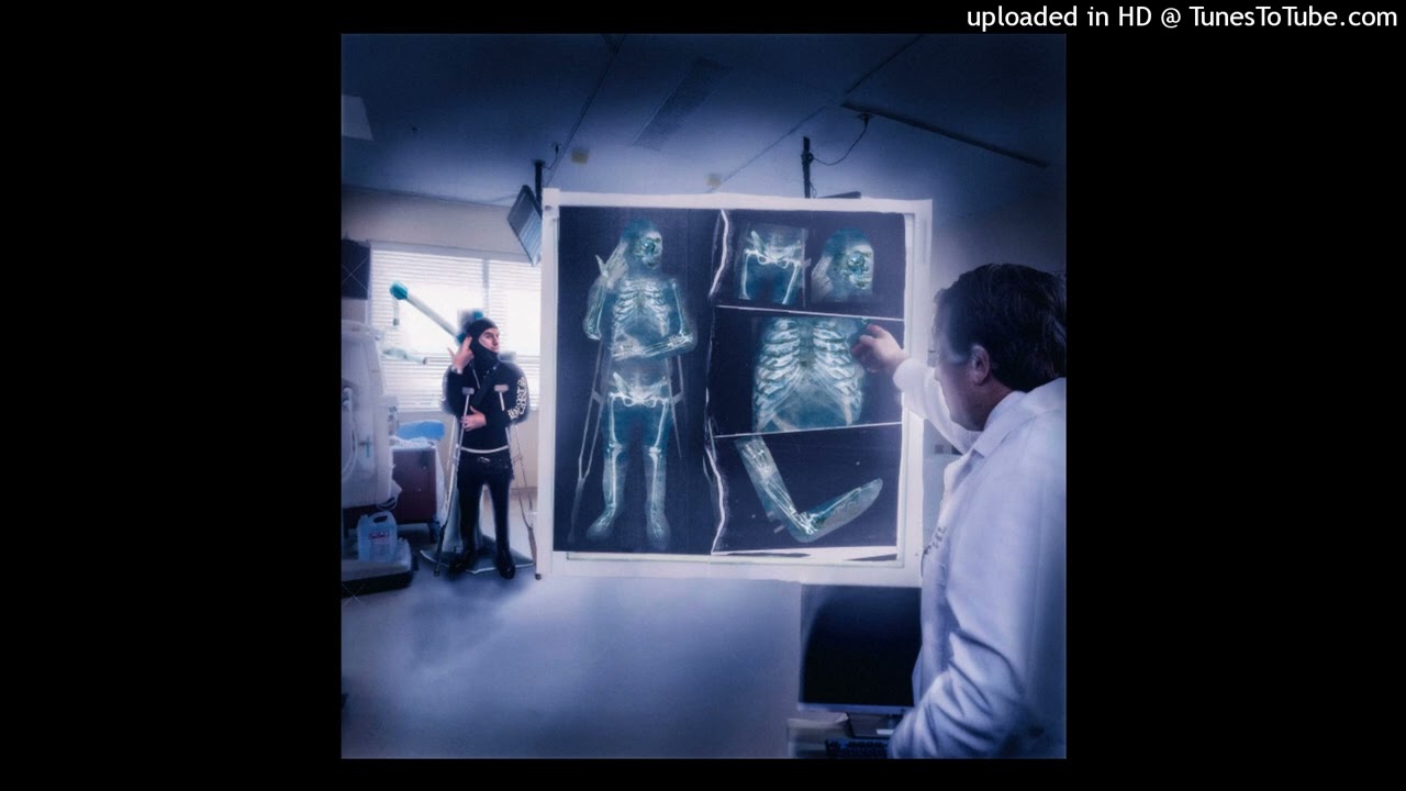 [ free ] yeat + bnyx + afterlyfe type beat - 